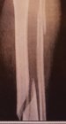 20170304_181317__01.jpg