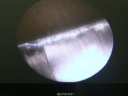 Crown Damage3.JPG