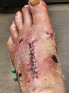 footpic.jpg