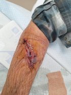 Sako arm damage.jpg