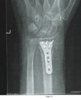 xray.jpg