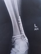 20161130_152428.jpg 20161130_152428.jpg