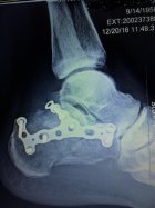 IMG_0777.JPG IMG_0777.JPG