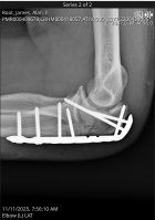 IMG_7875.jpeg IMG_7875.jpeg